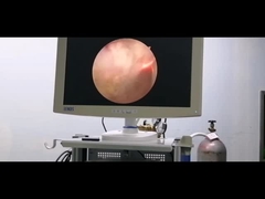 Электрод урологии системы хирургии плазмы RF для доброкачественной простатической гиперплазии